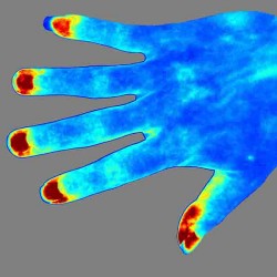 RFLSI-ZW Laser Speckle...